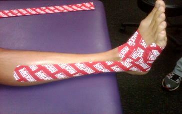 Woman athlete with fascial movement tape